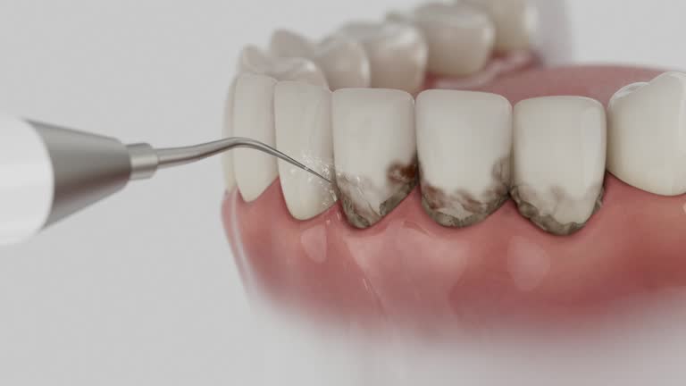 Trusted Dental Crowns And Bridges service in Raymond, MS - Dentist Open Now